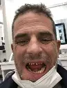 I need crack 